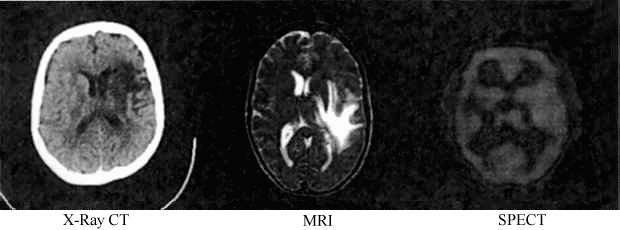 Fig 2. Brain images acquired with different imaging modalities