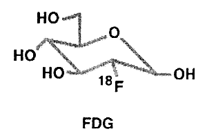 Fig 4. 18F-labeled 2-deoxyglucose (FDG)